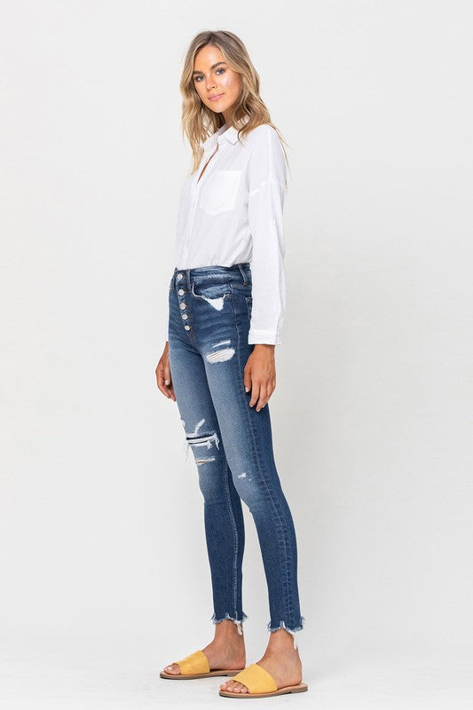 Sophie High Rise Patched Button Up Raw Hem Ankle Skinny